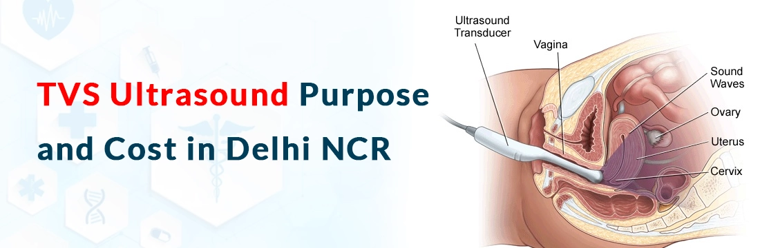 TVS Ultrasound: Purpose and Cost in Delhi NCR